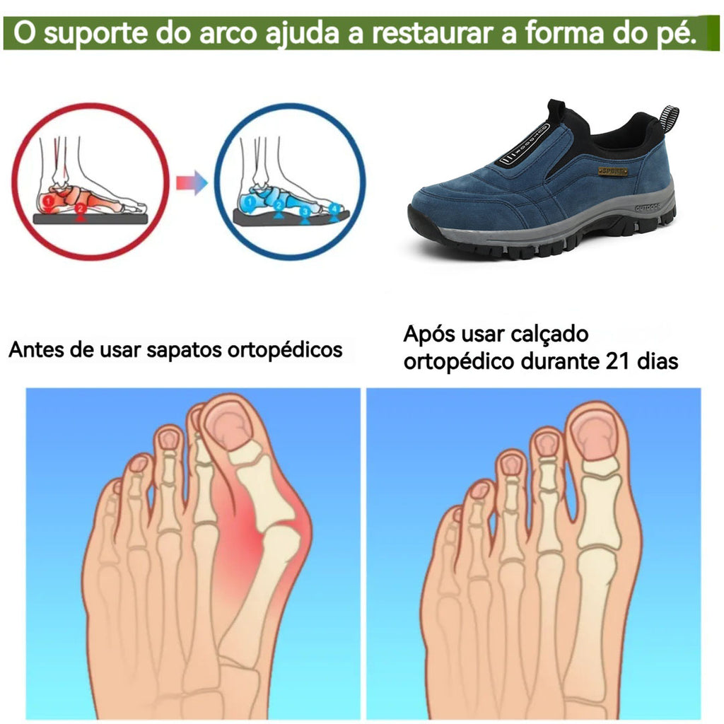 Taconver® – Scarpe ortopediche mediche dal design ergonomico che alleviano il dolore alla schiena, alle articolazioni e alle gambe.