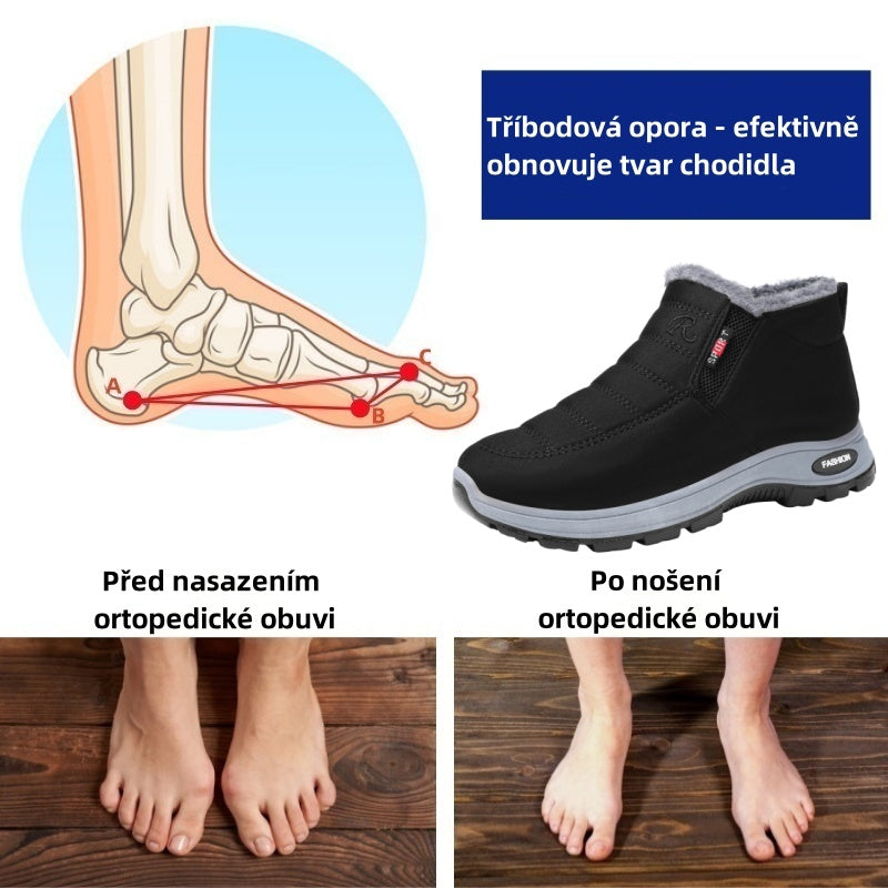 taconver® - Calçado ortopédico ergonómico de inverno para dores nos pés, joelhos e costas - Unissexo